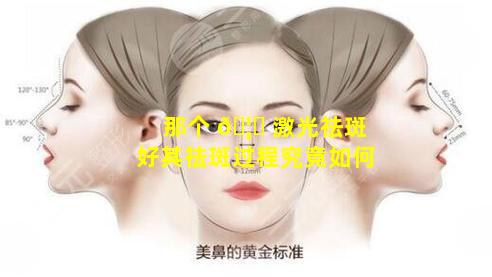 那个 🦊 激光祛斑好其祛斑过程究竟如何